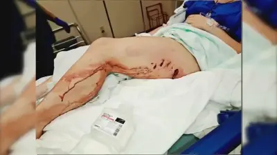 Teen escapes alligator attack in creek near Pensacola